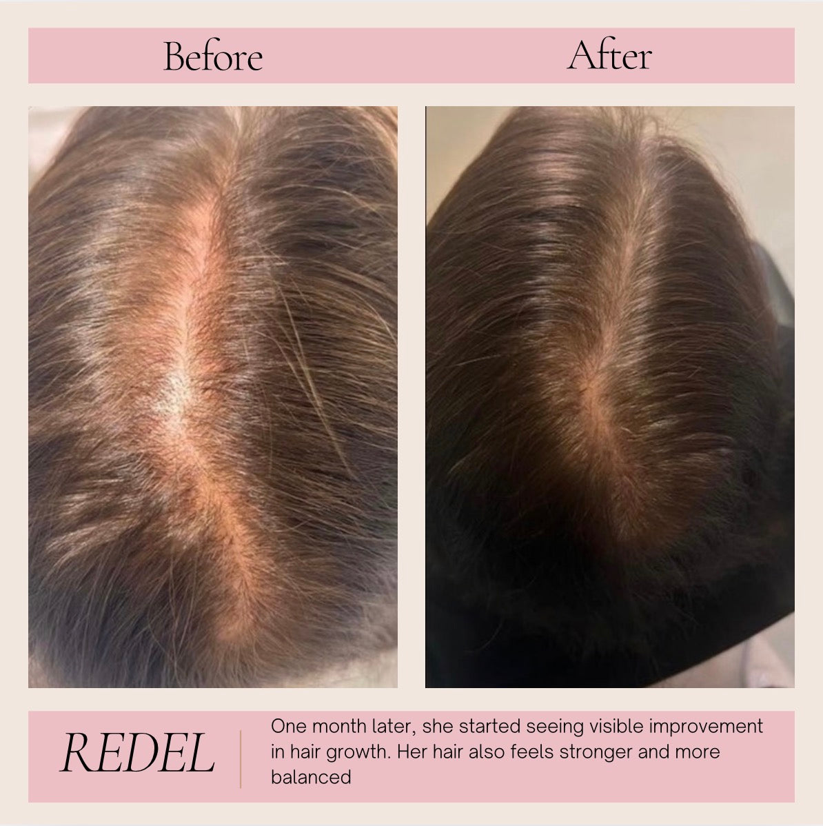 3‑in‑1 Red Light Hair & Scalp Massager for Stronger Hair