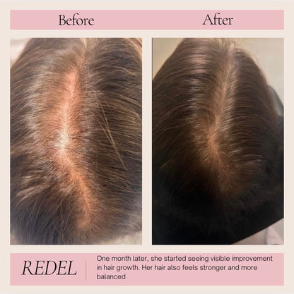 3‑in‑1 Red Light Hair & Scalp Massager for Stronger Hair