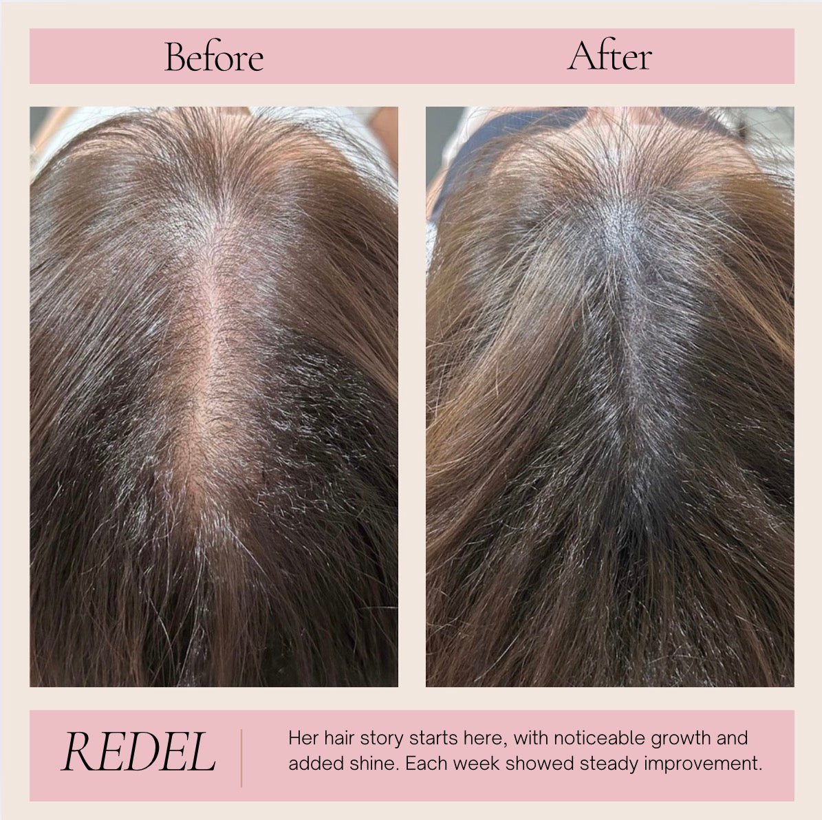 3‑in‑1 Red Light Hair & Scalp Massager for Stronger Hair