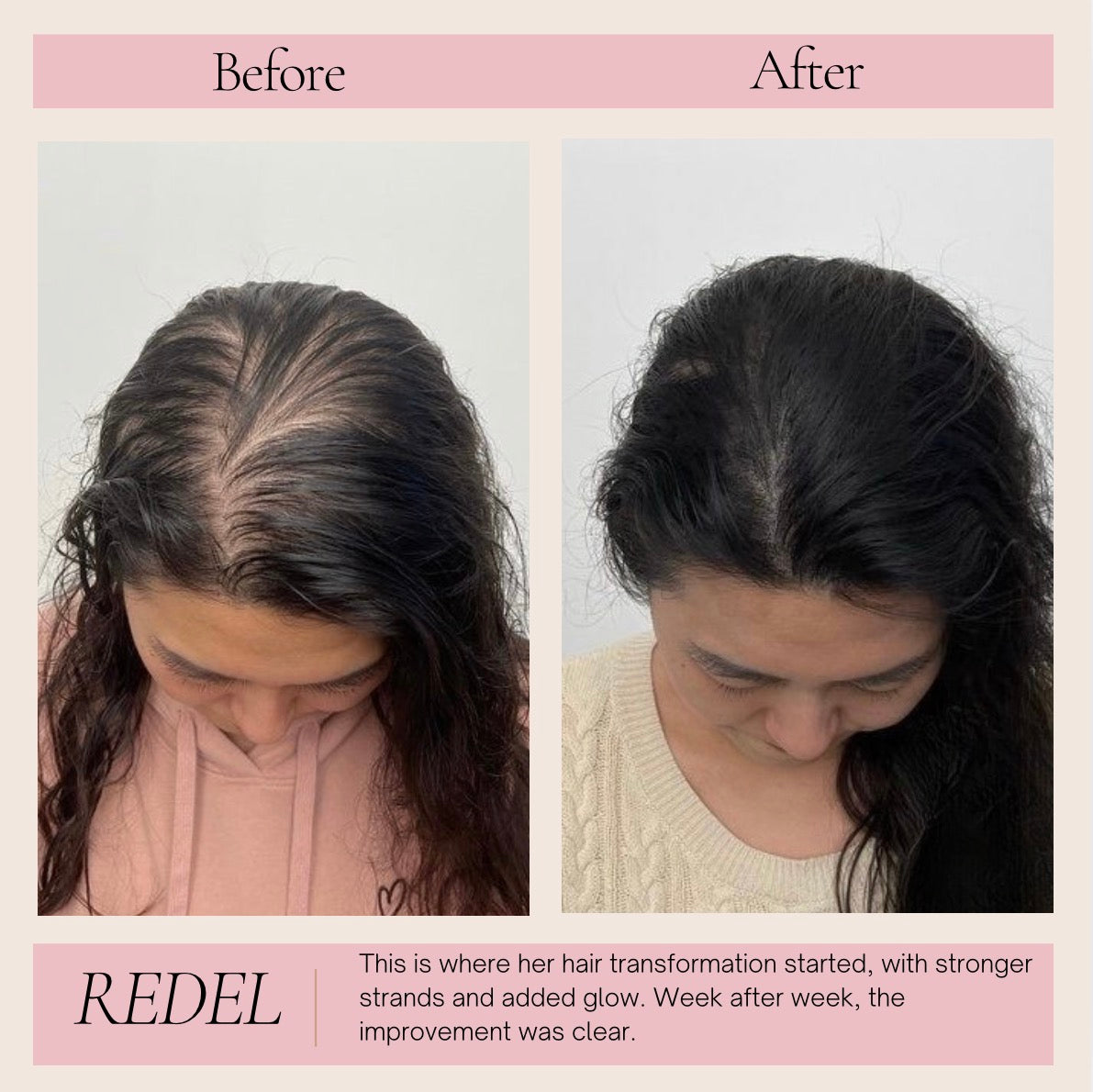 Hair Growth & Scalp Serum for Healthier Hair