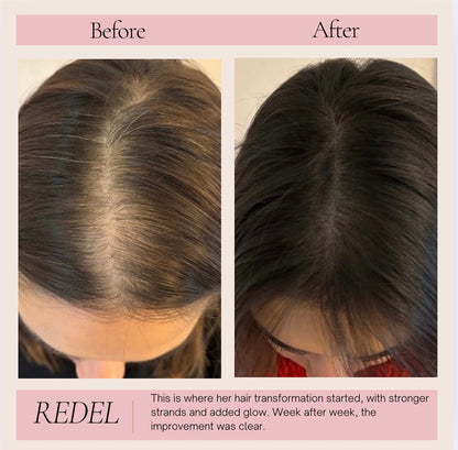 Hair Growth & Scalp Serum for Healthier Hair